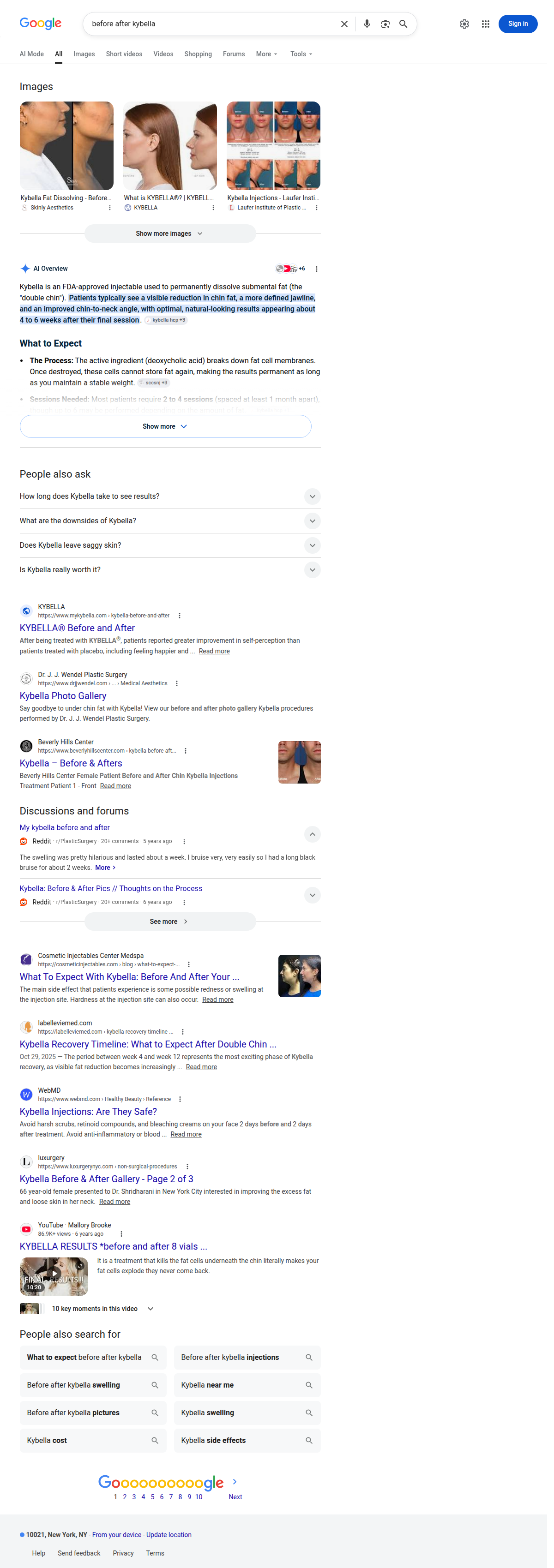 Google search results for before after kybella in New York